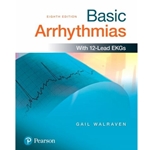 BASIC ARRHYTHMIAS
