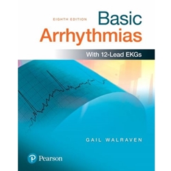 BASIC ARRHYTHMIAS